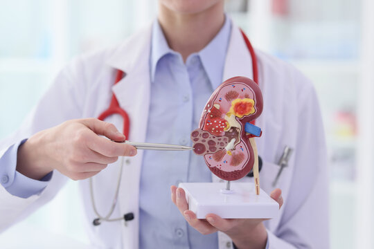 Kidney Cancer Treatment in Mumbai: A Kidney Doctor Explains Diagnosis and Treatment Options