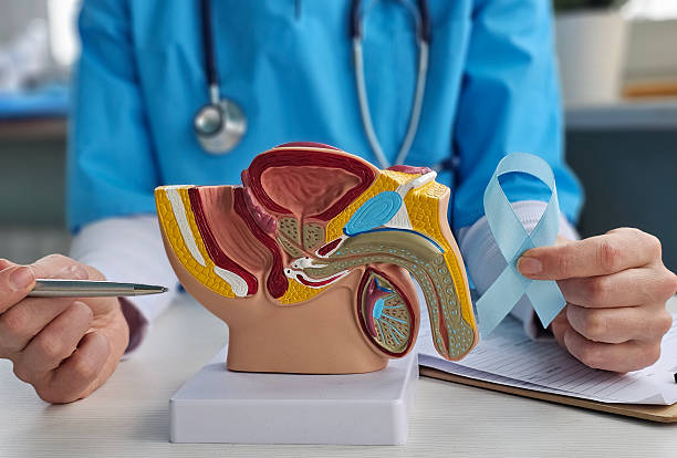 7 Common Myths About Prostate Cancer – Expert Insights from a Prostate Cancer Specialist in Mumbai