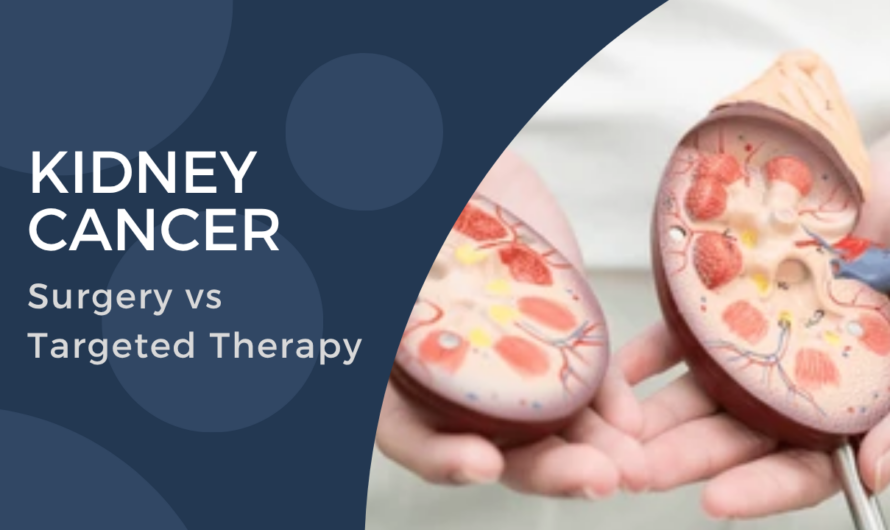 Best Treatment Options for Kidney Cancer in Mumbai: Surgery vs Targeted Therapy