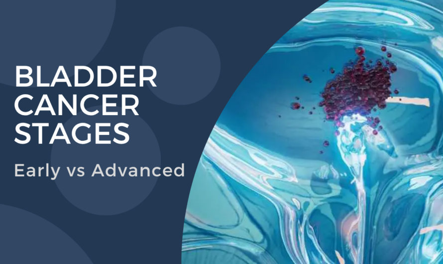 Bladder Cancer Stages: Early vs Advanced – What Patients Must Know