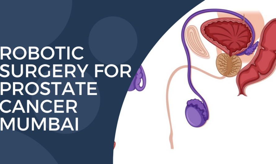 Robotic Surgery for Prostate Cancer: Benefits & Cost in Mumbai