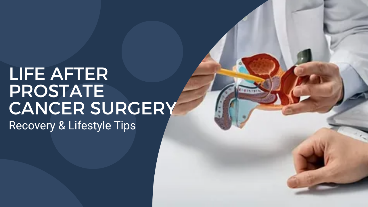 Life After Prostate Cancer Surgery: Recovery & Lifestyle Tips from uro oncologist