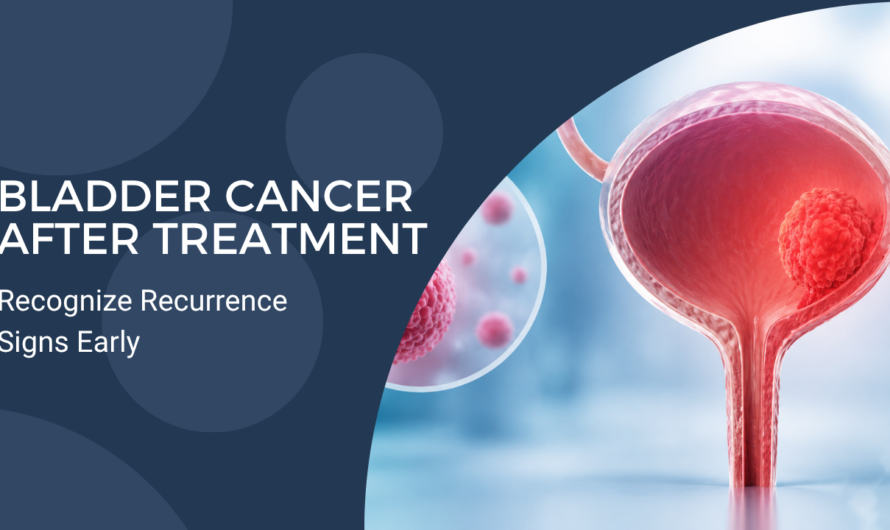 Can Bladder Cancer Come Back After Treatment? Understanding Recurrence