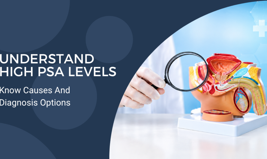 High PSA Levels: Does It Always Mean Prostate Cancer?